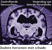 Dementie of hersenveroudering bij de oudere hond. Dierenkliniek Wilhelminapark in Utrecht